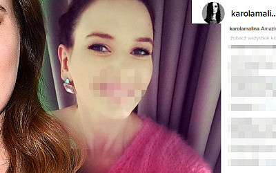Karolina Malinowska poprawiła zęby, fanki pod wrażeniem (Instagram)