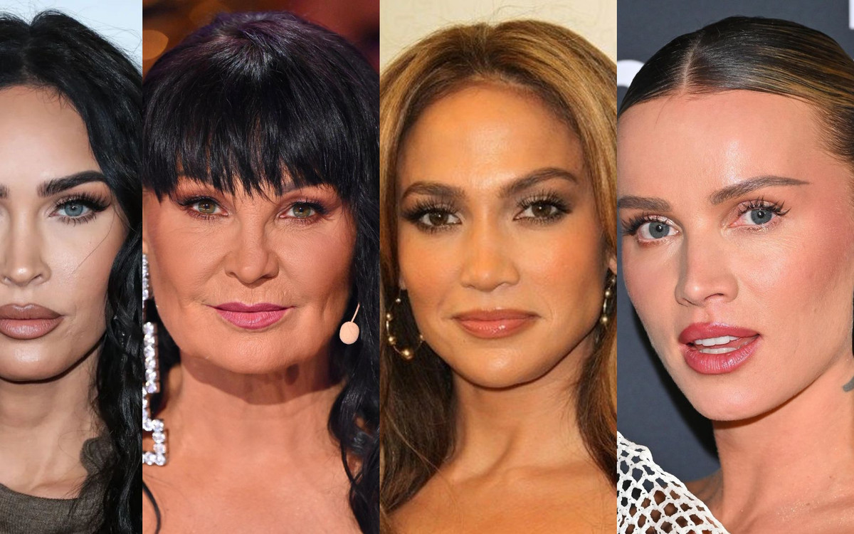 Gwiazdy poprawiły nos i zmieniły swój wizerunek. Efekt robi wrażenie?