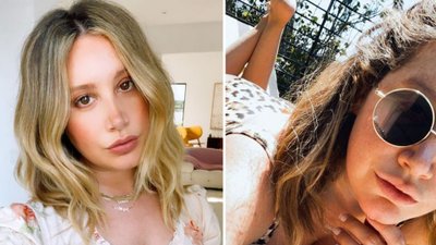 Ashley Tisdale pokazała zdjęcie piersi po usunięciu implantów