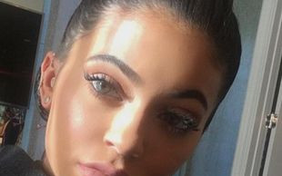 Kylie Jenner zdradza, dlaczego nie usunie blizny (FOTO)