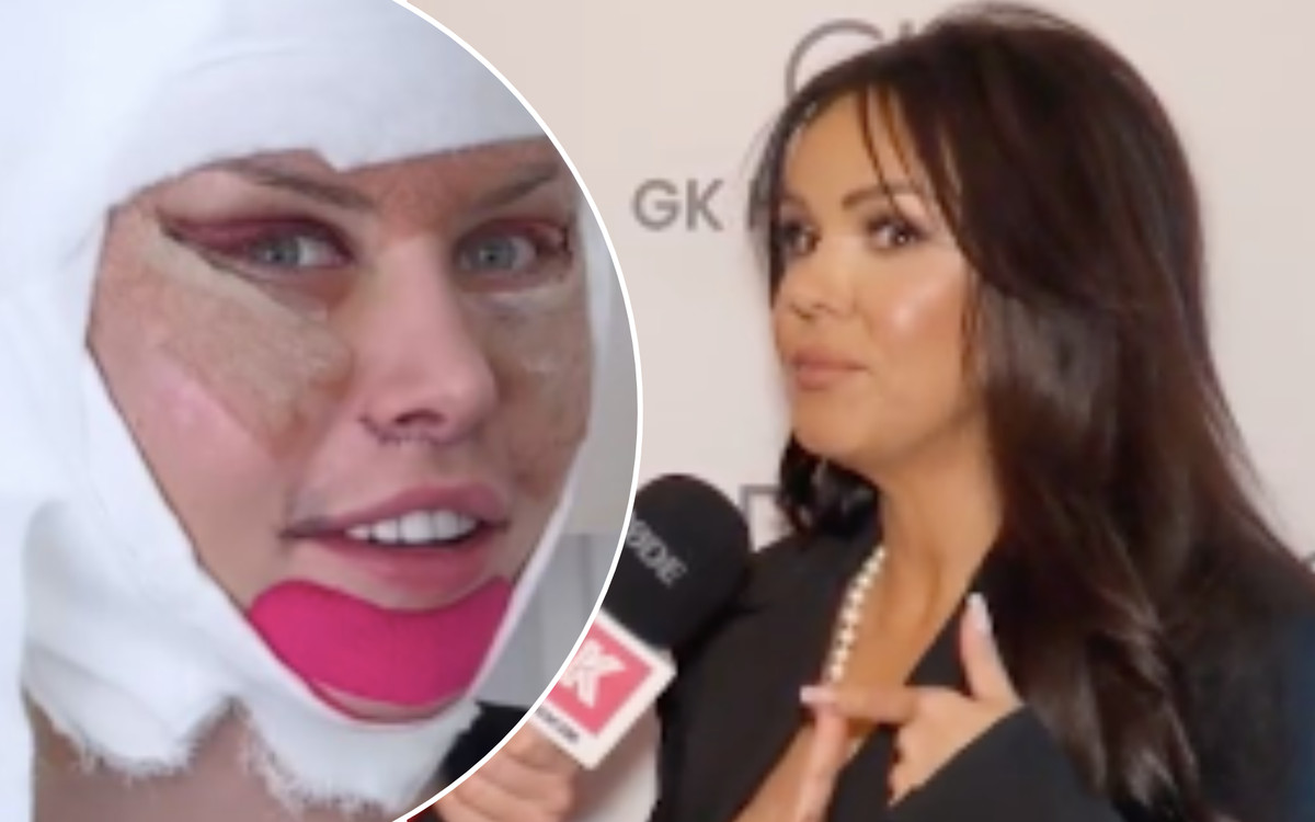 Nie mogła uwierzyć! Sylwia Bomba mocno o liftingu Julii von Stein