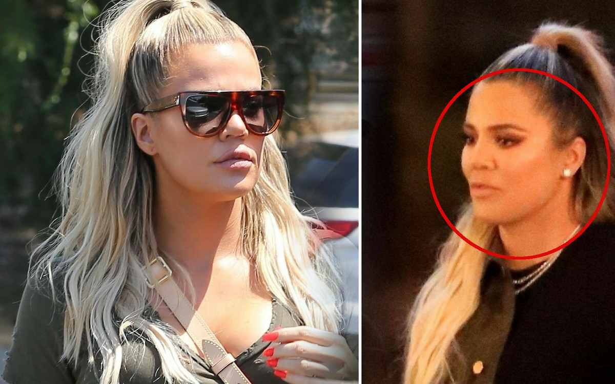 Khloe Kardashian planuje operację TEJ części ciała!  To jej ogromny kompleks