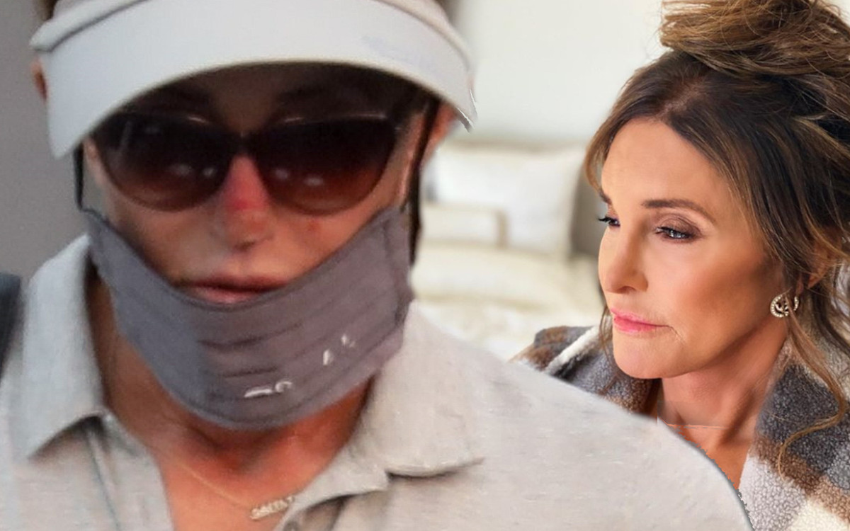 Caitlyn Jenner ma NIEPOKOJĄCE zmiany na skórze. To rak?