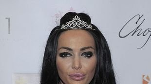 Dramat Orzechowskiej na wózku: Nie mogę uprawiać seksu!