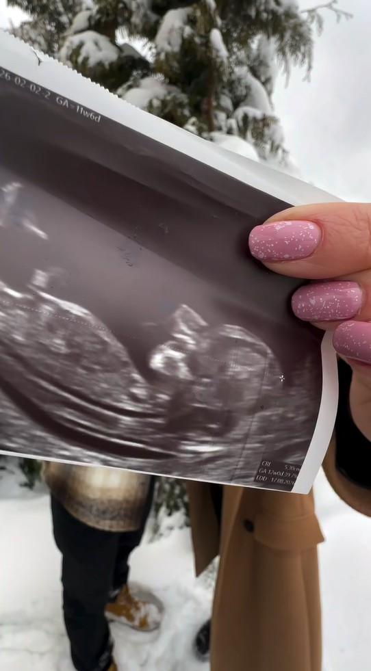 Kolejna ciąża w polskim show-biznesie, fot. Instagram