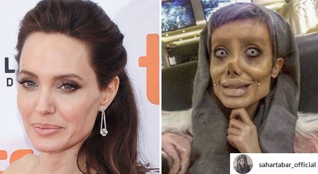 Jej marzeniem było być jak Angelina Jolie, a teraz STRASZY swoim wyglądem