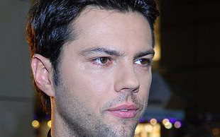 Olivier Janiak zrobił sobie tylko górne zęby