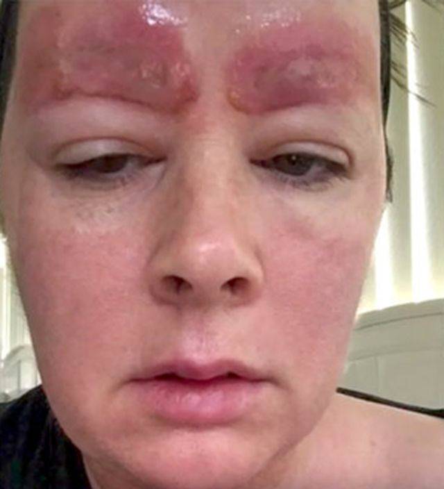 Jej marzeniem były piękne brwi, a z salonu wyszła Z TYM