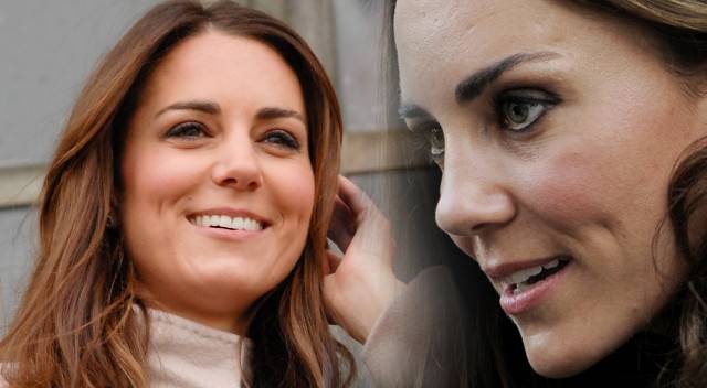 Chirurg plastyczny o tym, co poprawiła sobie księżna Kate