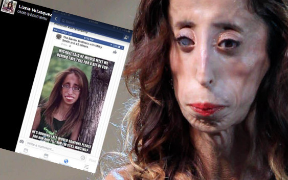 Lizzy Velasquez nie chce być bohaterką obraźliwych memów