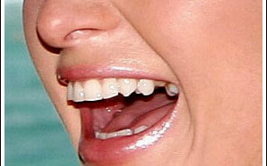 Kto potrzebuje dentysty?