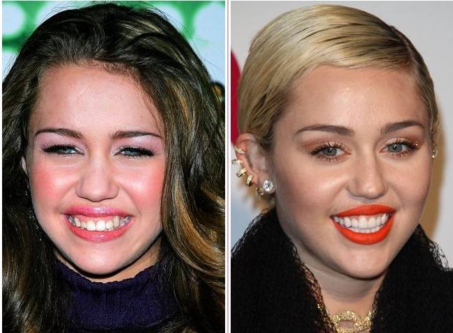 Nie ma ludzi brzydkich, są tylko biedni