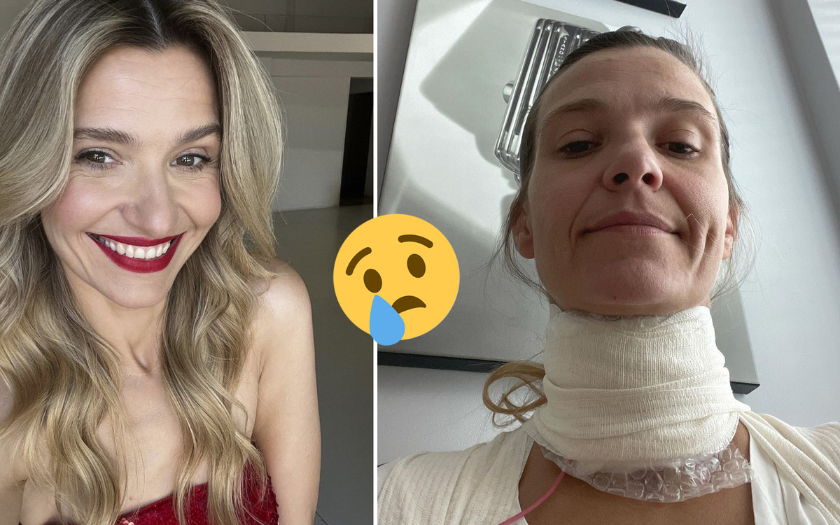 Obandażowana Joanna Koroniewska przeraziła fanów! Zrzuciła winę na męża