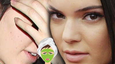 Wystarczyła maseczka z tych dwóch składników, by Kendall Jenner pozbyła się trądziku!