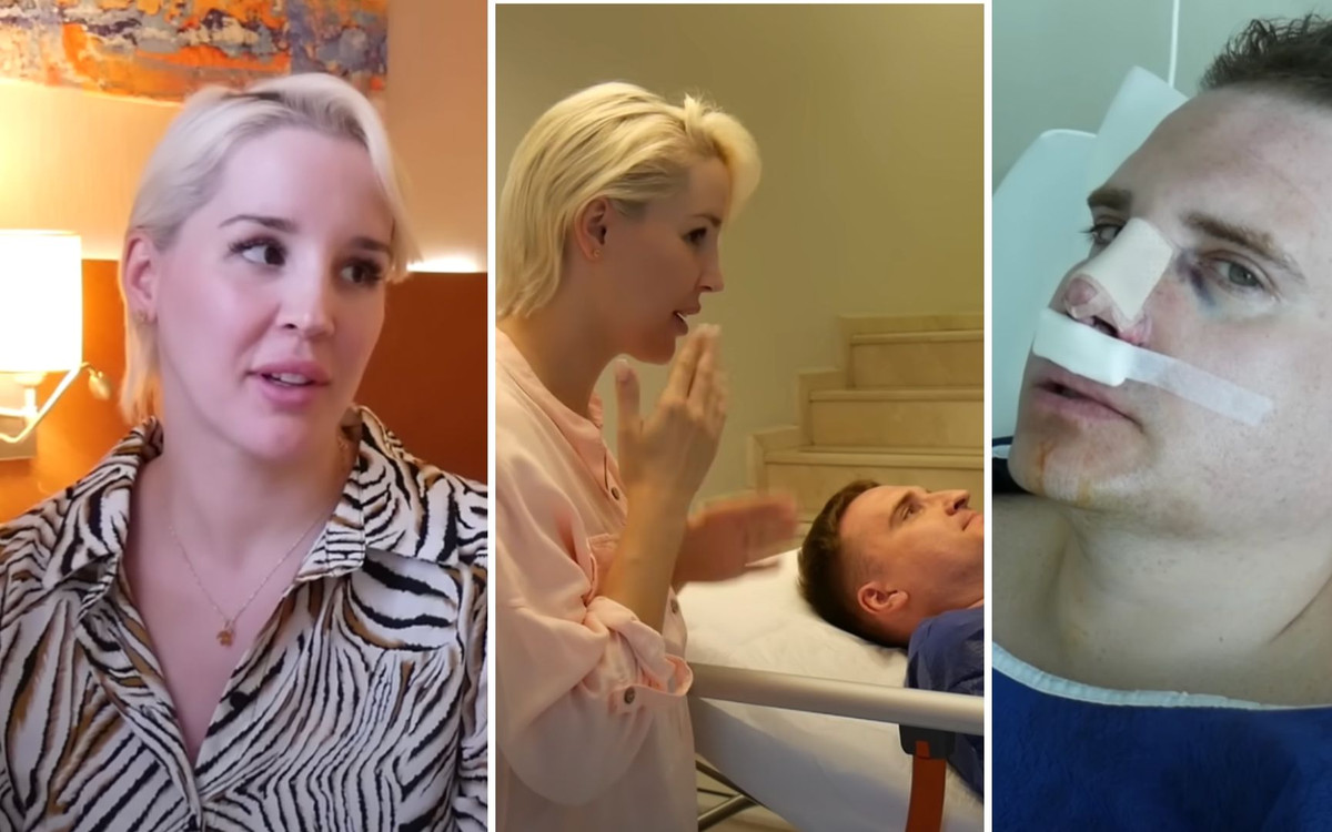 Partner Lil Masti przeszedł operację plastyczną w Turcji