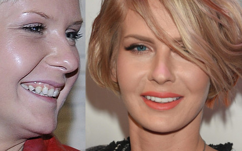 Jak zęby zmieniły twarze gwiazd