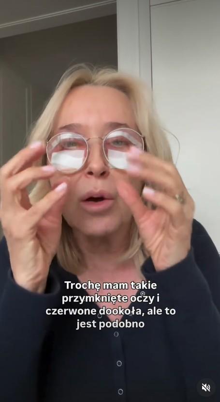 Agata Młynarska przeszła blefaroplastykę, fot. Instagram