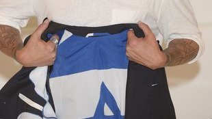 Połamał palce, zwichnął dłonie (FOTO)