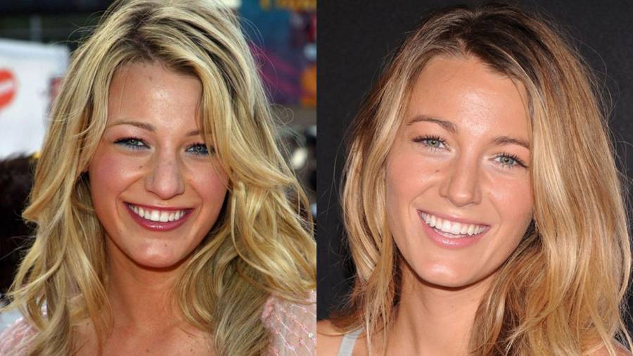 Blake Lively/ Instagram