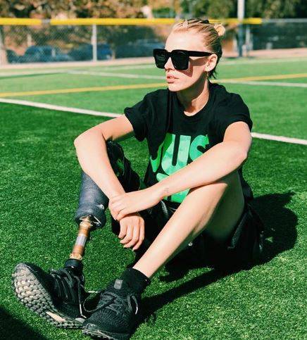 Modelka straciła nogę przez TAMPONY. Podzieliła się SZOKUJĄCYMI szczegółami