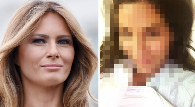 Zrobiła sobie szereg operacji plastycznych, żeby wyglądać jak Melania Trump