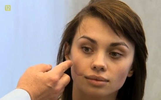 Uczestniczki Top Model pod skalpelem (FOTO)