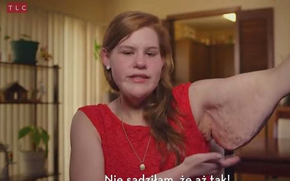 Choć schudła ponad 100 kg, wciąż nie może na siebie patrzeć!