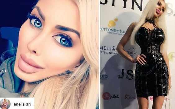 Anelli zaszkodziły OPERACJE! Ma poważne problemy ze zdrowiem (Instagram)