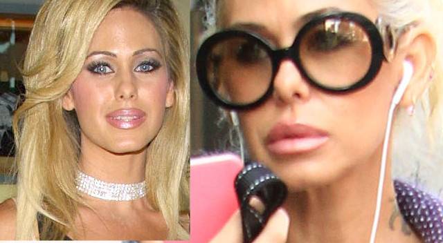 Gwiazdy, które trudno rozpoznać bo NAPOMPOWAŁY usta