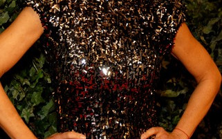 Jak się goją zmniejszone usta Lisy Rinny? (FOTO)