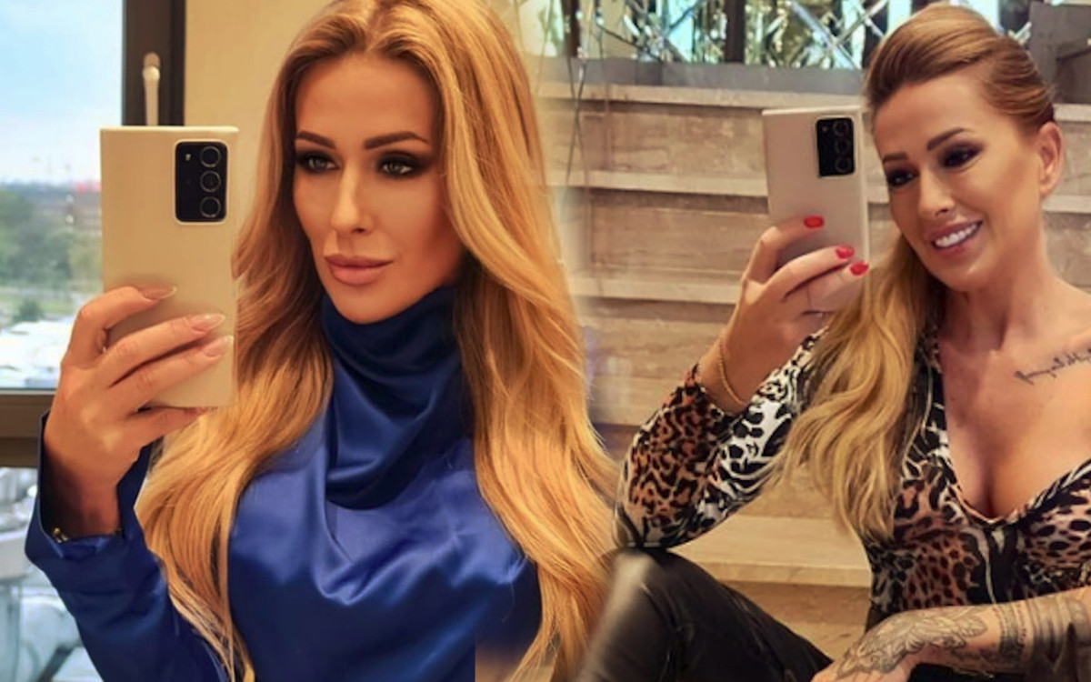 Królowe życia: Sylwia Peretti pokazała przerażające poparzenia na twarzy