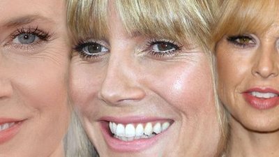 One powiedziały botoksowi: Nie (FOTO)