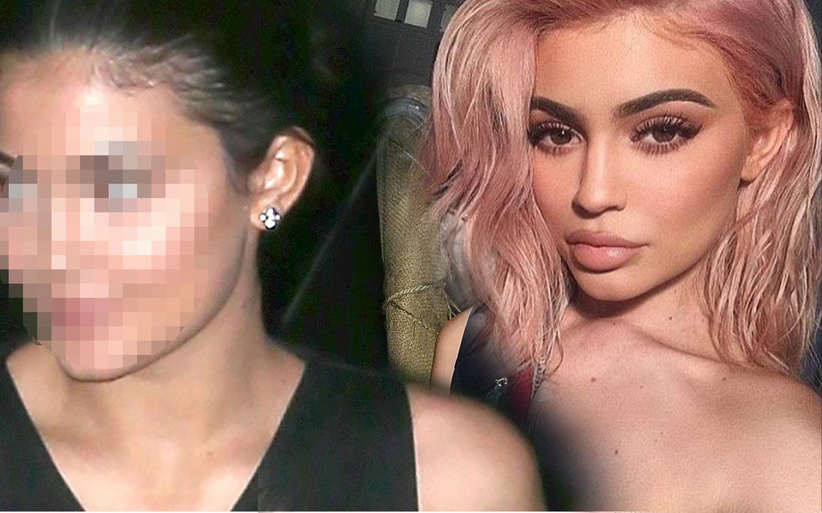 Małe USTA Kylie zmieniły jej twarz! Teraz wygląda zupełnie inaczej