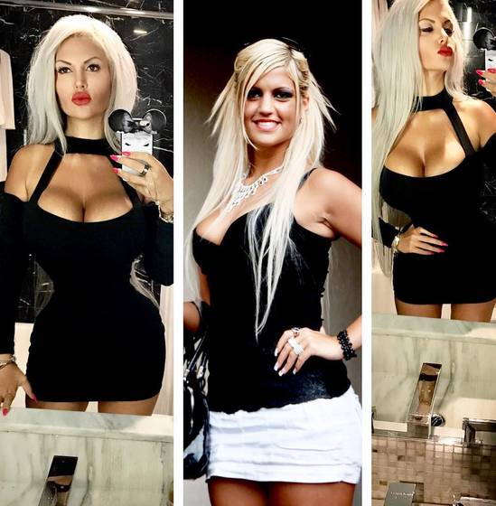 Nie mogła schudnąć, więc wycięła ŻEBRA. Jest szczuplejsza, ale…