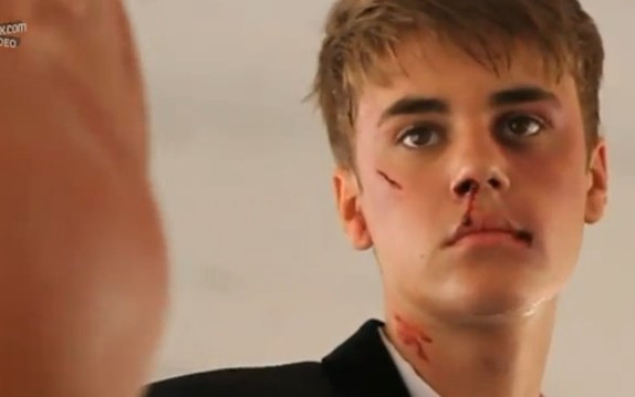 Justin Bieber oberwał – aż krew się leje (FOTO)