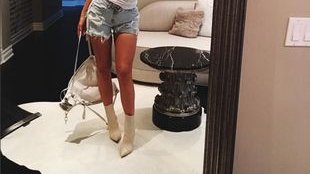 Skąd na nodze Kylie Jenner wzięła się ta blizna? (Instagram)