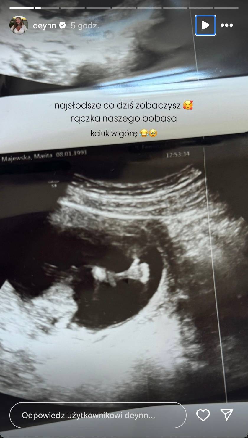 Tak Deynn zareagowała na ciążę. Pokazała archiwalne nagranie: “Mam emocje szczęścia i przerażenia”