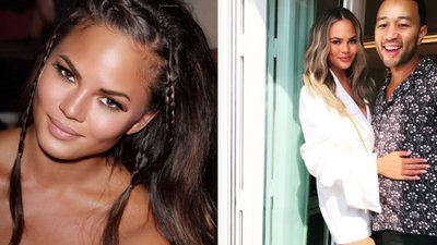 Chrissy Teigen tłumaczy się ze stosowania BOTOKSU W CIĄŻY