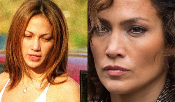 Jak operacja nosa zmieniała twarze gwiazd