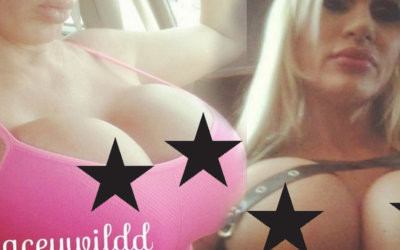 Jej piersi już ważą 20 kg, a to tylko początek operacji!