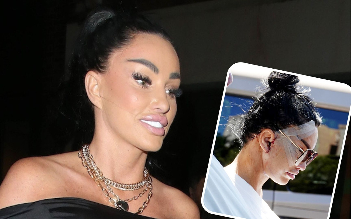 Katie Price po swoim 6 liftingu twarzy! Zauważona przed hotelem w Turcji