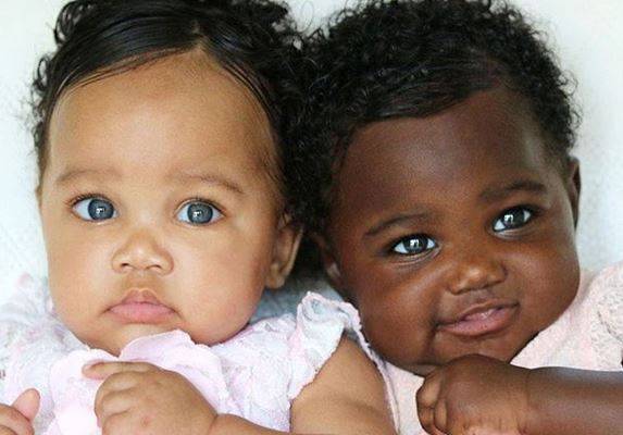 Te bliźniaczki są gwiazdami na Instagramie. Wszystko przez JEDEN szczegół