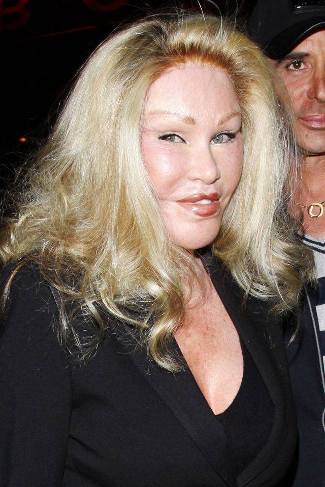 Jocelyn Wildenstein, czyli Kobieta Kot – wydała fortunę, żeby wyglądać jak potwór