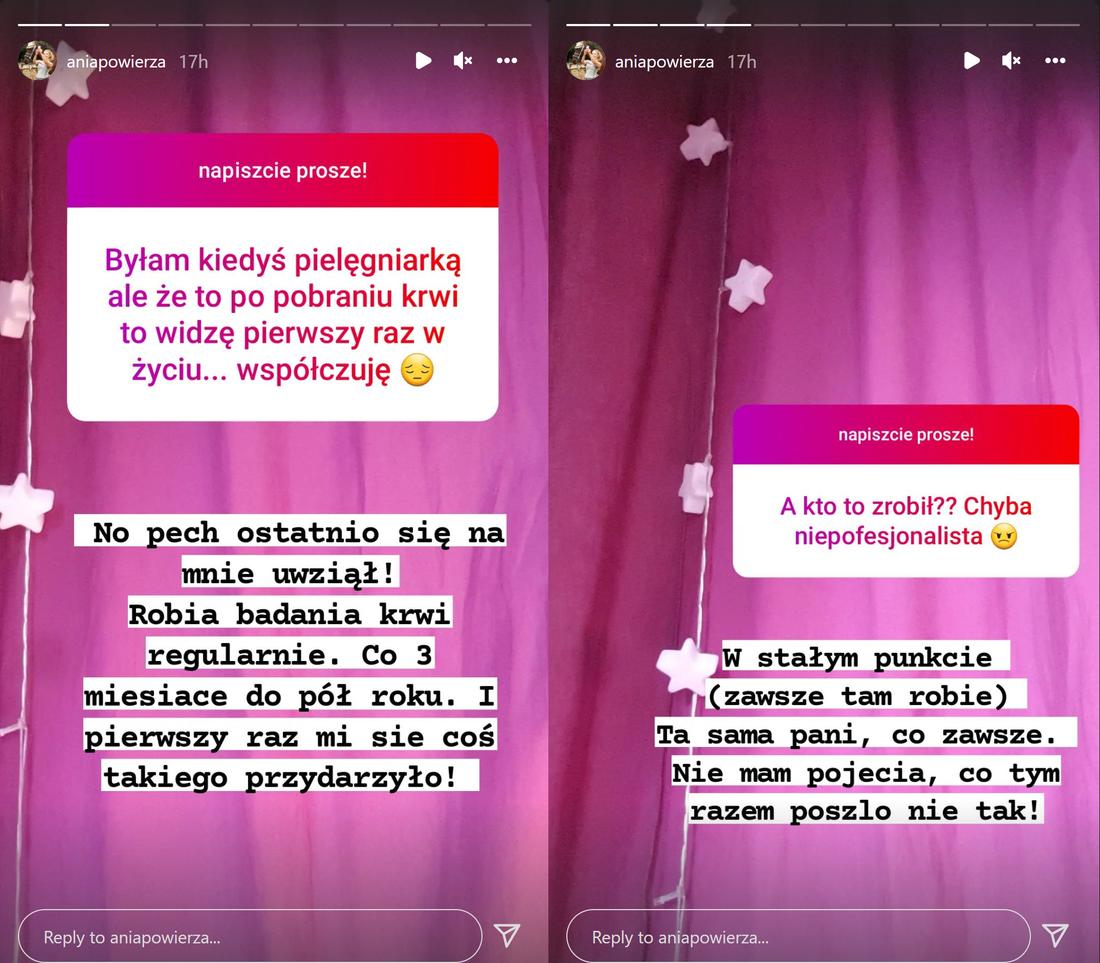 Anna Powierza pokazała rękę całą w SINIAKACH! Co się stało?