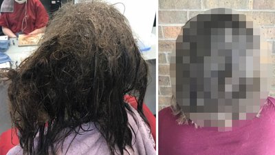 Fryzjerka ODMÓWIŁA chorej na depresję zgolenia głowy na zapałkę