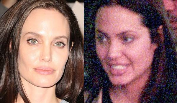 Jak operacja nosa zmieniała twarze gwiazd