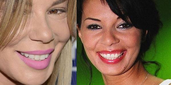 Jak zęby zmieniły twarze gwiazd