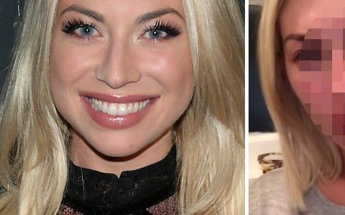 Stassi Schroeder pokazała twarz bez makijażu, z łuszczycą (ZDJĘCIA)