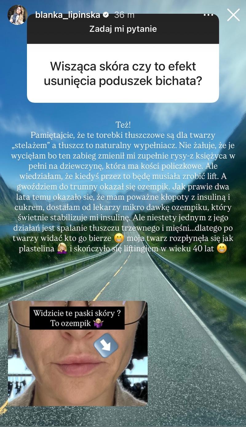 Instagram @blanka_lipinska