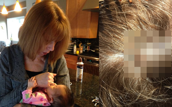 Fryzjerka uratowała jej życie! Zauważyła coś niepokojącego…